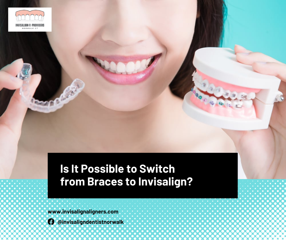 Can you switch from braces to Invisalign? Learn who qualifies, costs, timeline changes, and what to expect at DentalBraces Norwalk.