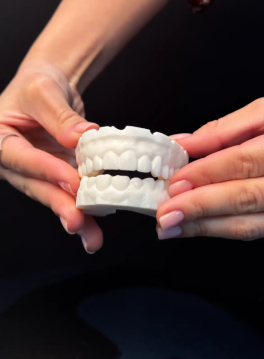 Considering Veneers? Start Here